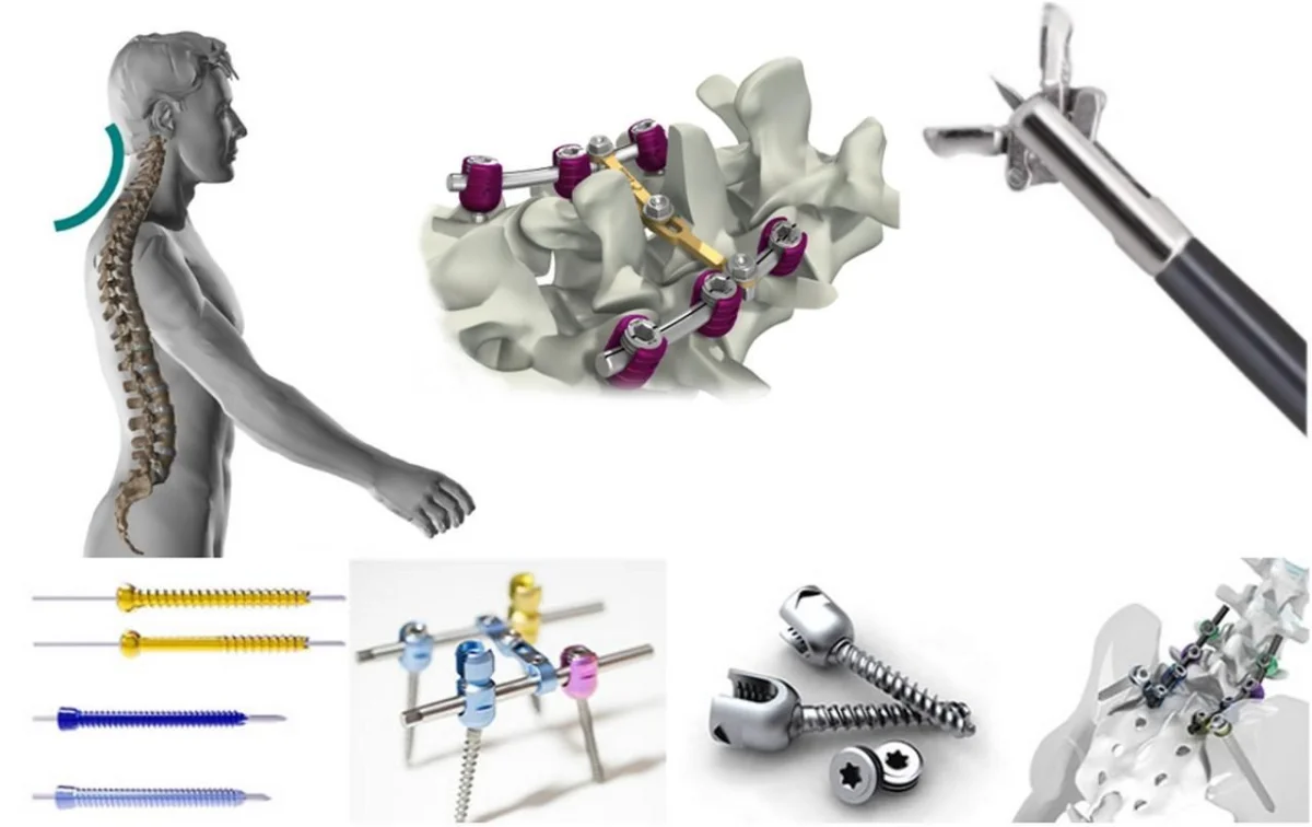 Reverse Engineering & Custom Manufacturing — Nitro İnovasyon Sanayi ve Ticaret Ltd. Şti.